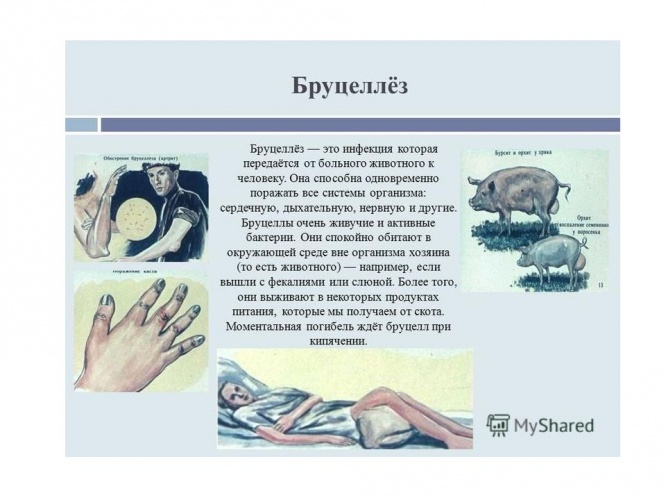 Эпидемиологическая ситуация по бруцеллезу в Московской области