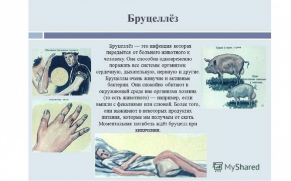 Эпидемиологическая ситуация по бруцеллезу в Московской области