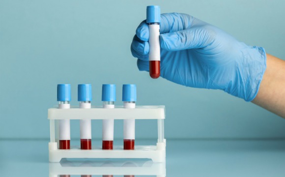 Сотрудники красногорского «Швабе» сдали 480 литров донорской крови в 2023 году