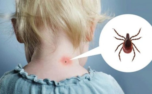 Как защитить детей от клещей