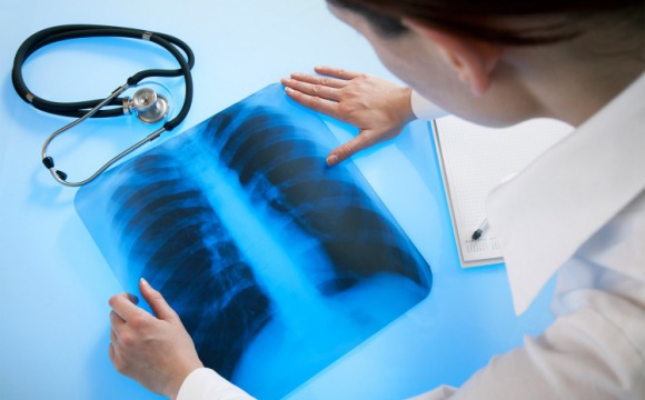 Рентген‑установка стоимостью более 30 млн руб начала работать в больнице Красногорска