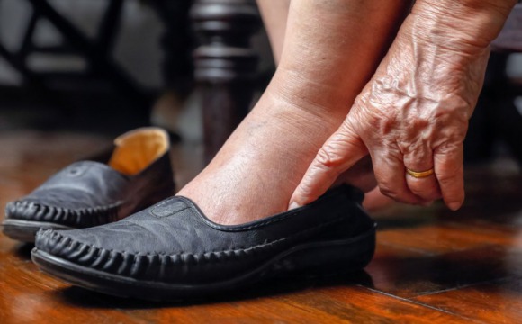 Омбудсмен Подмосковья помогла жительнице Серпухова получить качественную ортопедическую обувь
