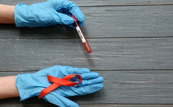 Зачем нужно знать свой ВИЧ статус