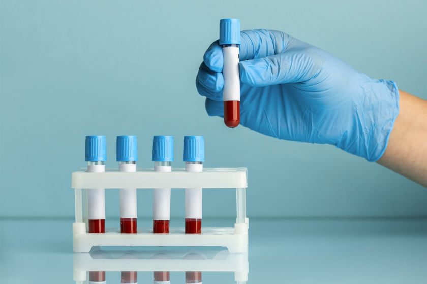 Вклад в национальное здоровье: сотрудники «Швабе» сдали более 200 литров крови