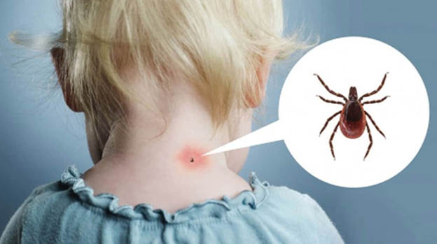 Как защитить детей от клещей