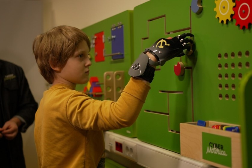 Для Глеба изготовили индивидуальный протез пальцев