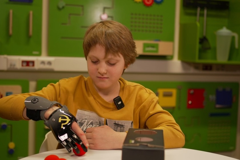 Для Глеба изготовили индивидуальный протез пальцев